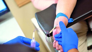 Trasplantes de riñones con hepatitis