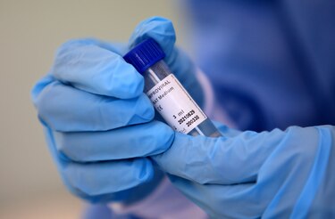 Costa Rica detecta coronavirus en aguas residuales