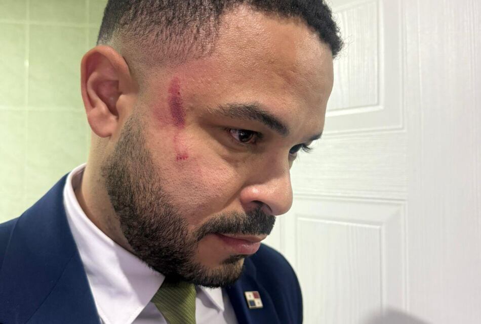 Agresión de Bolota Salazar a Betserai Richards queda impune: Corte archiva denuncia