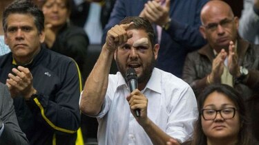 CIDH pide a Venezuela proteger vida e integridad de Juan Requesens