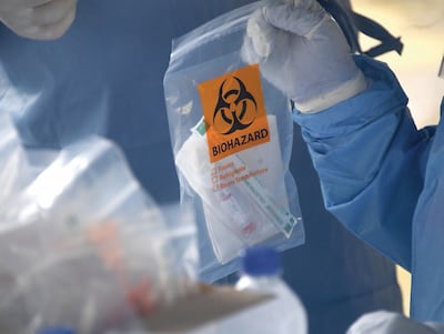 Imponen cuarentena en varios hospitales de Siberia por sospecha de peste pulmonar