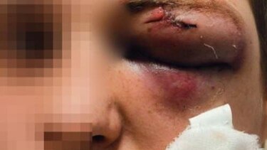 Por qué cada vez más jóvenes rusos se están uniendo a grupos neonazis