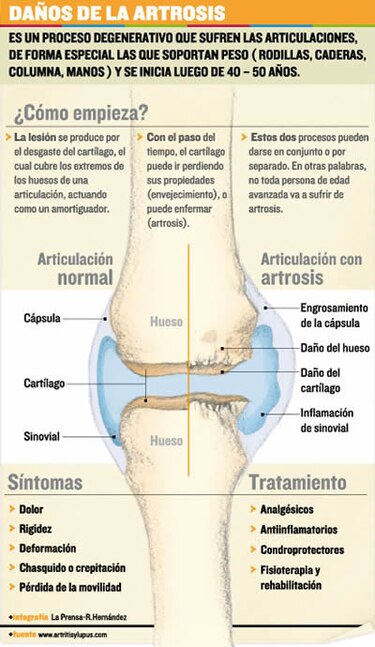 Artrosis, grito de las articulaciones