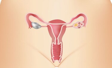 Tras la amenaza del silencioso cáncer de ovario