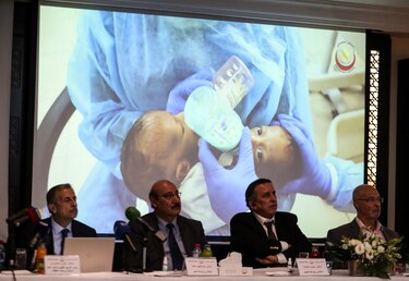 Dos bebés siameses yemeníes, separados con éxito tras compleja operación en Jordania