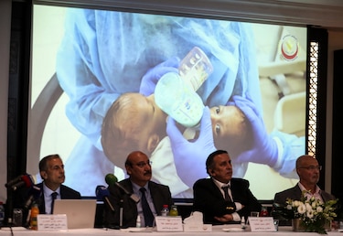 Dos bebés siameses yemeníes, separados con éxito tras compleja operación en Jordania
