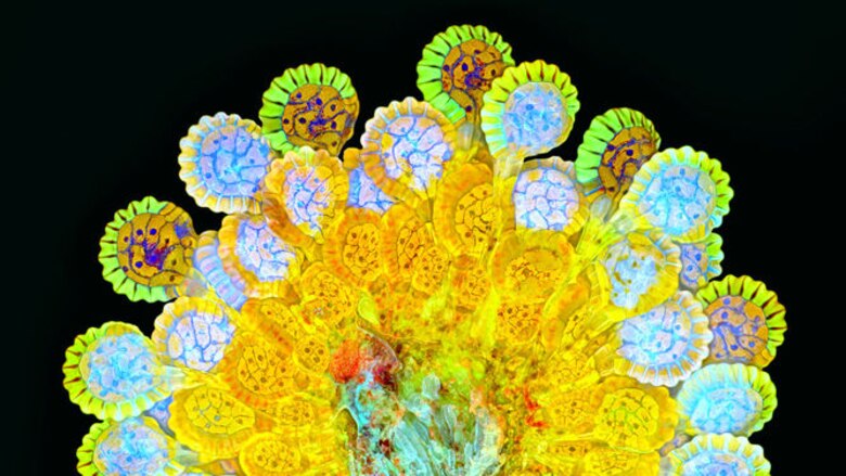 El arte de la fotomicrografía