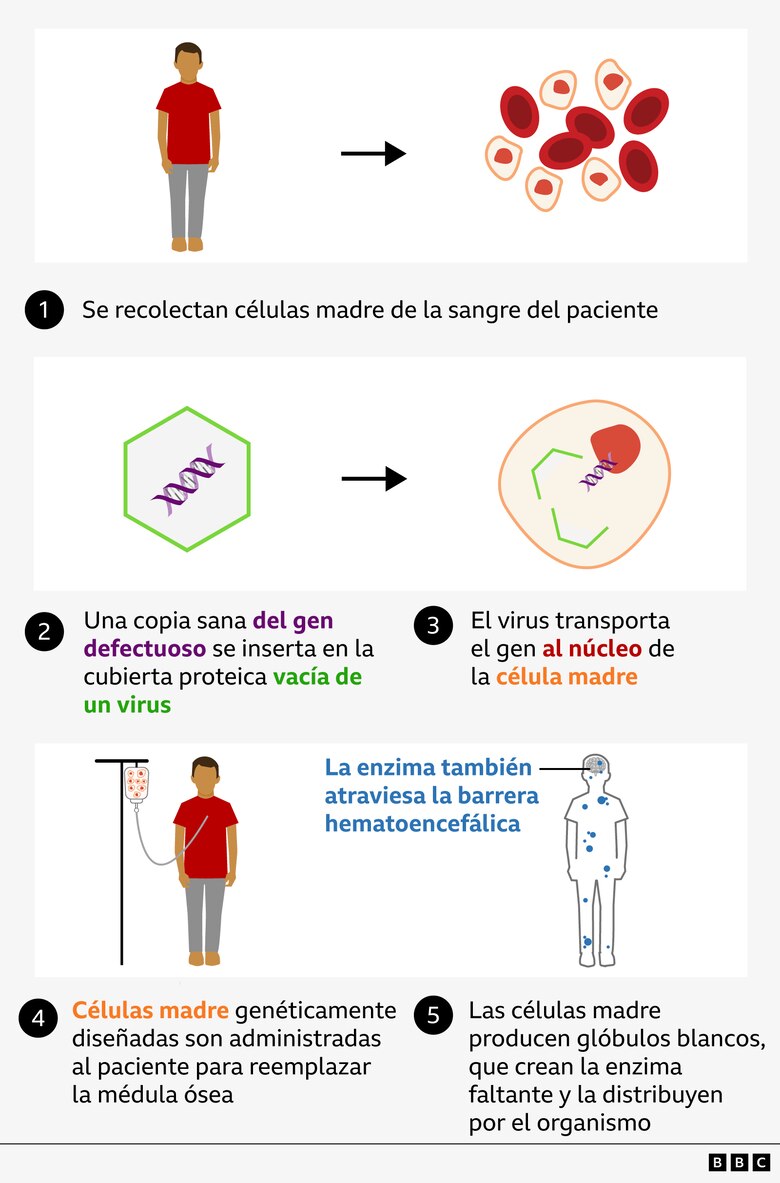 El niño de 3 años con una enfermedad rara que asombra a los médicos por su recuperación tras recibir una pionera terapia genética