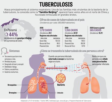 Cepa de tuberculosis Beijing, con alta prevalencia en Colón