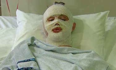 Joven de Estados Unidos describe experiencia en ataque en Bruselas: 'Fui afortunado'