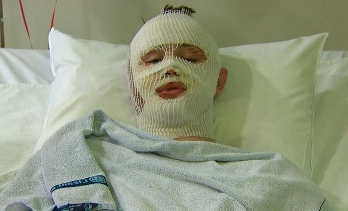Joven de Estados Unidos describe experiencia en ataque en Bruselas: 'Fui afortunado'