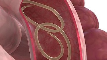 Malestar gastrointestinal:  ¿serán parásitos?