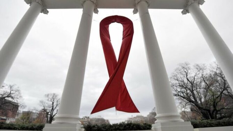 Segundo caso mundial de remisión del VIH en un paciente