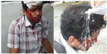 Diez periodistas heridos en cuatro horas durante represión en Venezuela, incluye camarógrafo de CNN