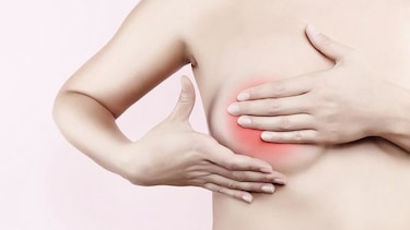 Ocho mitos del cáncer de mama