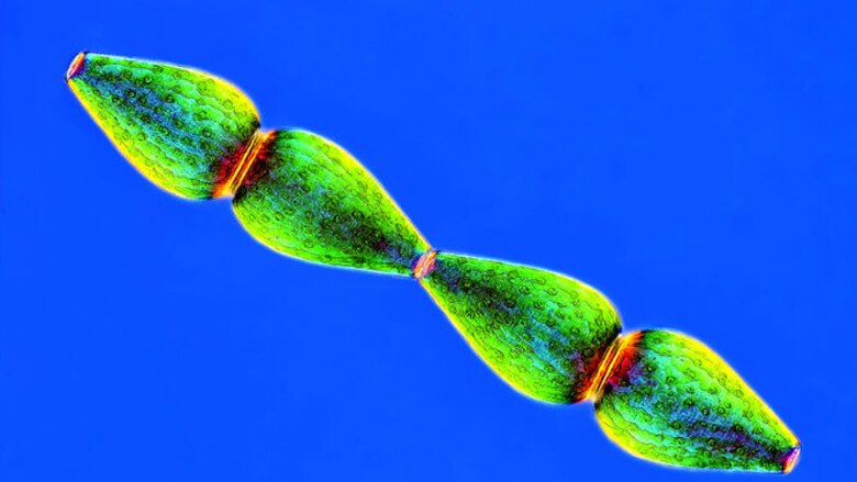 El arte de la fotomicrografía