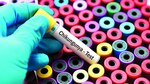 Presentan resultados de estudio sobre chikungunya