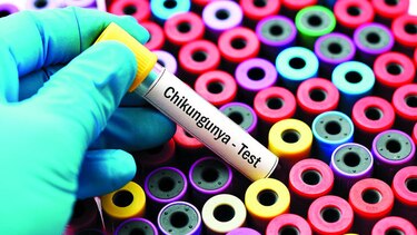 Presentan resultados de estudio sobre chikungunya