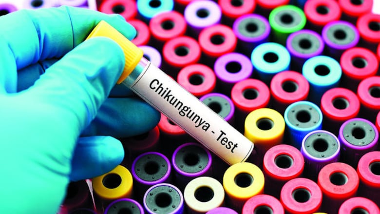 Presentan resultados de estudio sobre chikungunya