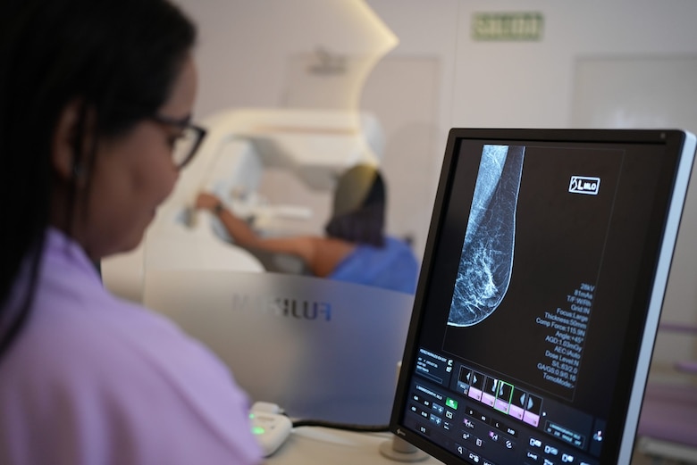 Mamógrafo con IA: la apuesta de la CSS para un diagnóstico más preciso del cáncer de mama