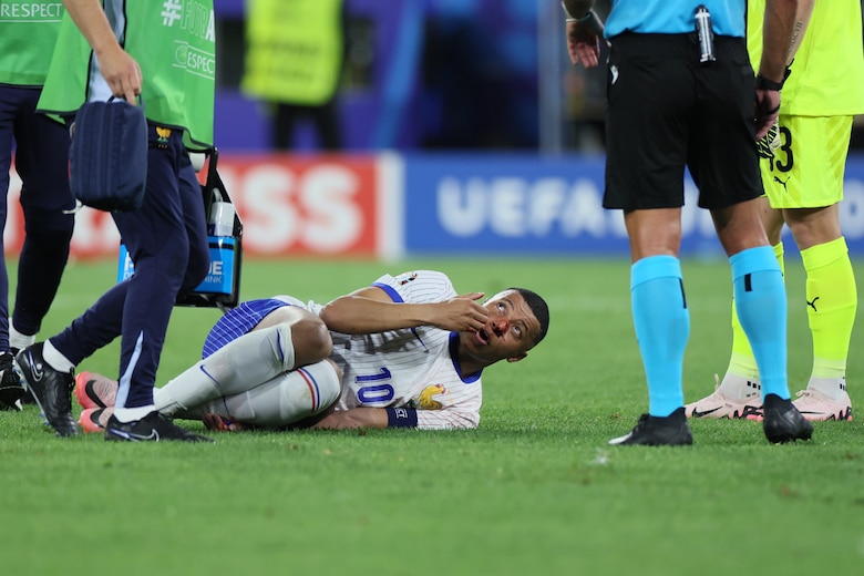 Francia suma una cara victoria ante Austria