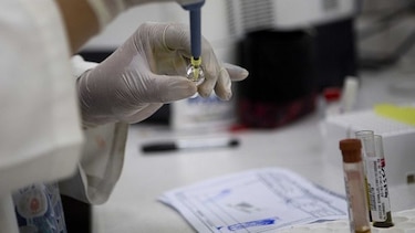 Cuándo una epidemia no debe ser sorpresa