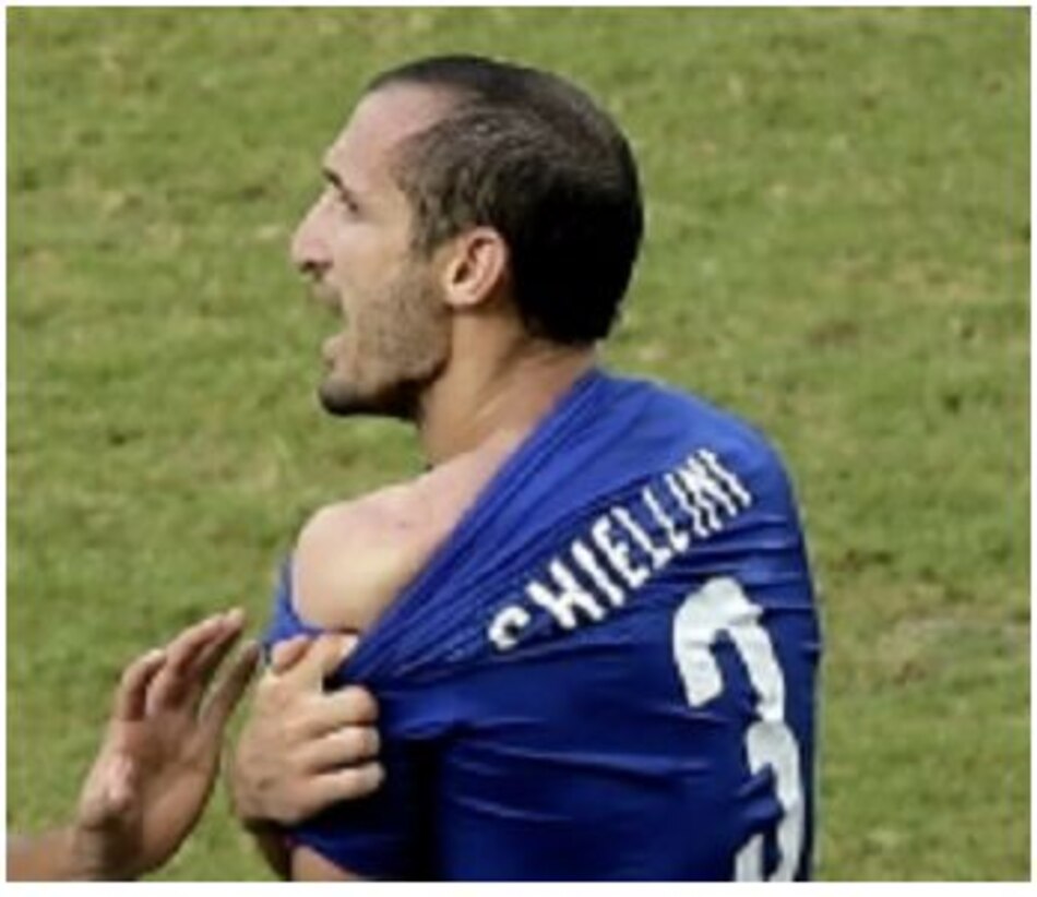 Chiellini cree 'excesiva' la sanción impuesta a Luis Suárez por su mordisco