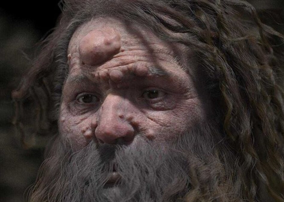 El hombre de Cromañón tenía la cara cubierta de nódulos