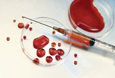 Un medicamento experimental logra curar la leucemia avanzada en 18 pacientes