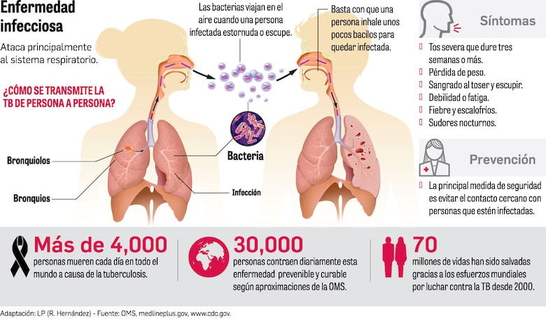 Tuberculosis en Panamá: 1,740 casos en 2024 y el desafío de la prevención