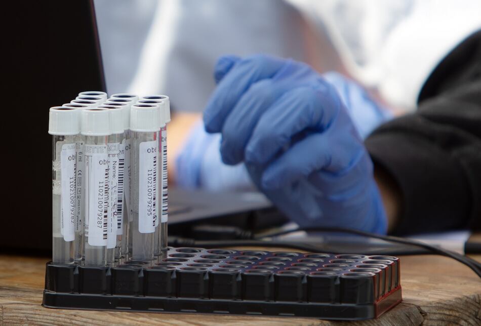 La vacuna debe estar aprobada, además de ser eficaz y segura para la población, dice la viceministra de Salud