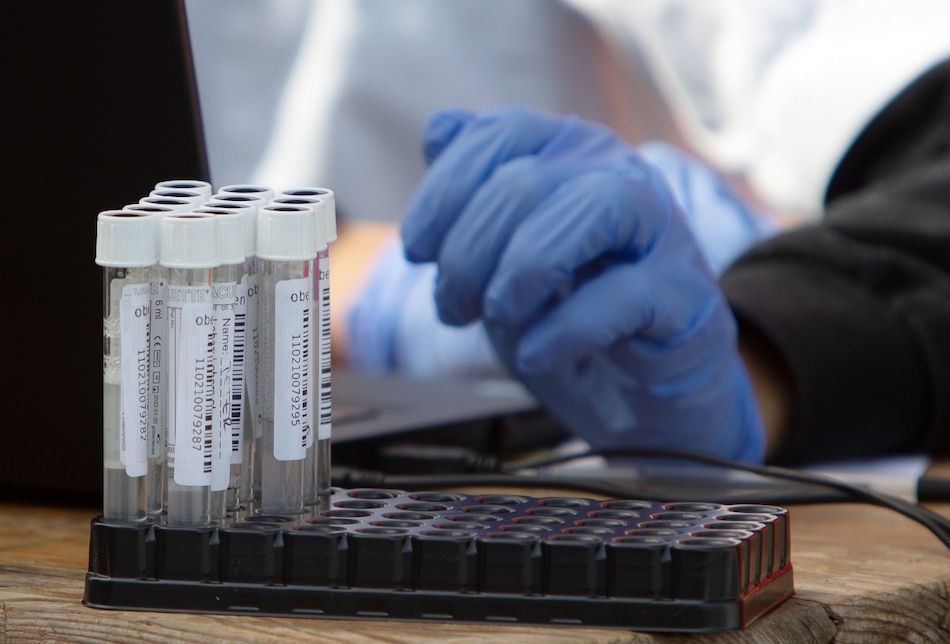 OMS apoya investigación en África de remedios naturales contra la Covid-19