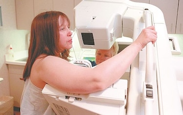 Sobre el cáncer de mama en etapa avanzada