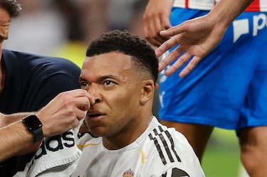 Mbappé, con puntos en una ceja, no se entrena por precaución