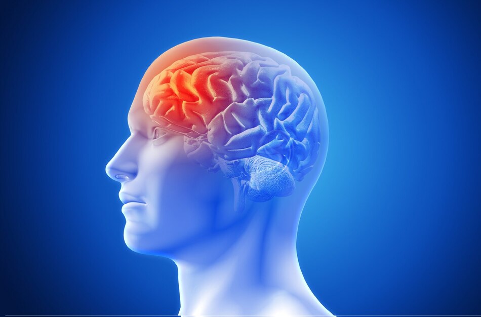 El tiempo marca la diferencia ante una enfermedad vascular cerebral