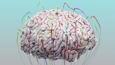 ¿Puede la estimulación tecnológica mejorar el funcionamiento de nuestro cerebro?
