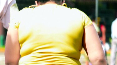 Otros alcances de la obesidad