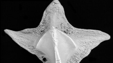 Dentículos: una mirada al pasado de los tiburones