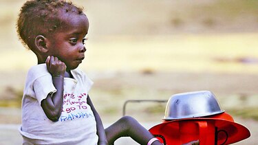 Niños desnutridos necesitan tratamiento