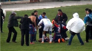 Jugador sobrevive al impacto de un rayo y habla de su milagro