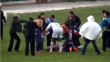 Jugador sobrevive al impacto de un rayo y habla de su milagro