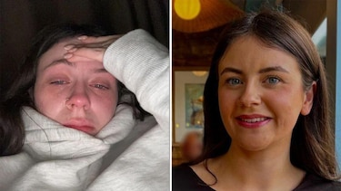 ‘Es como si la muerte viniera a buscarnos cada mes’: la pesadilla de vivir con el trastorno disfórico premenstrual