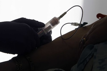 Un examen de sangre experimental detecta el cáncer de forma precoz