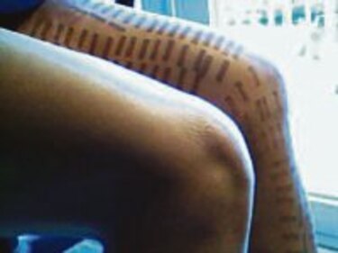 Inflamación y dolor