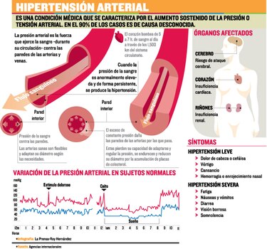 Hipertensión, mal de los riñones
