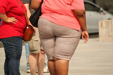 La obesidad aumenta el riesgo de complicaciones en pacientes de Covid-19