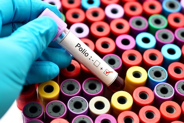 La sombra de la polio, de vuelta en Panamá