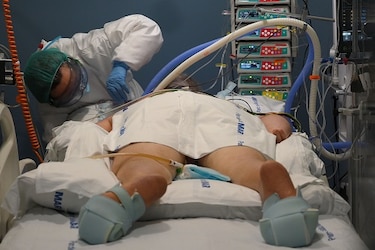 Solo uno de cada cuatro pacientes de Covid-19 se recupera totalmente tras un año, según estudio