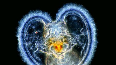 El arte de la fotomicrografía