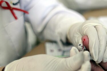 Pacientes de Sida luchan por iguales oportunidades de empleo